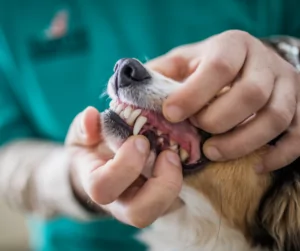 Gingivitis